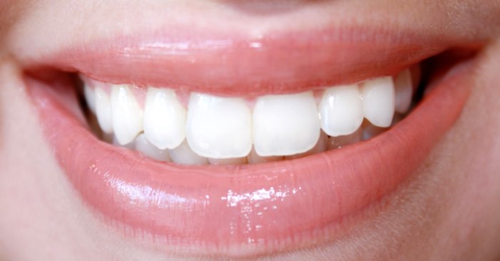 О кажущейся простоте домашнего отбеливания зубов