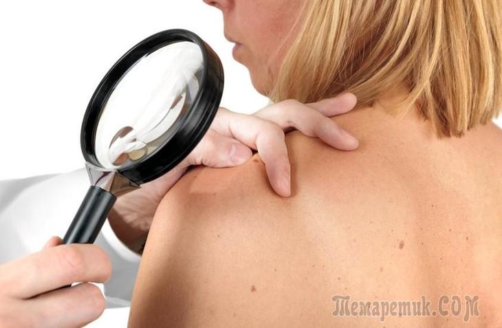 Причины кожных болезней и их лечение в восточной медицине