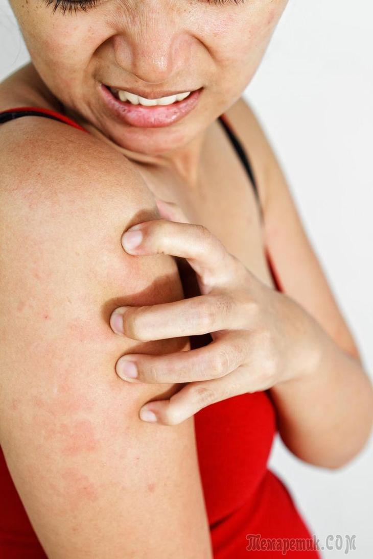 Причины кожных болезней и их лечение в восточной медицине
