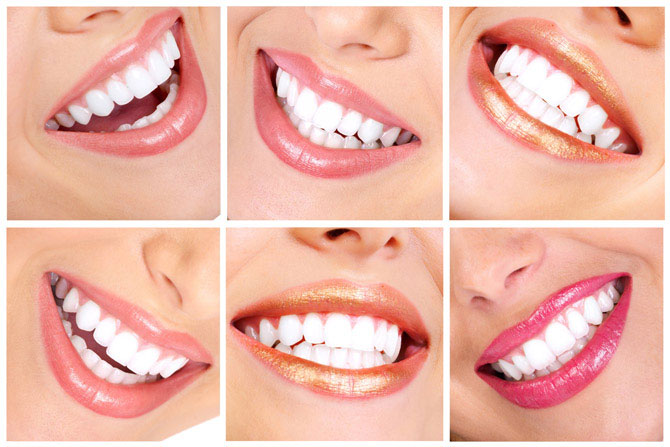 Безопасные способы отбеливания зубов в домашних условиях