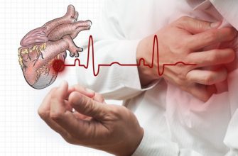 В случае сердечного приступа, у вас есть только 10 секунд, чтобы спасти свою жизнь! Вот, что необходимо делать!