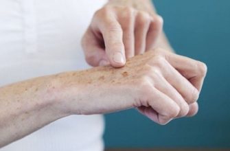 Попрощайтесь с пятнами, морщинами, веснушками и бородавками