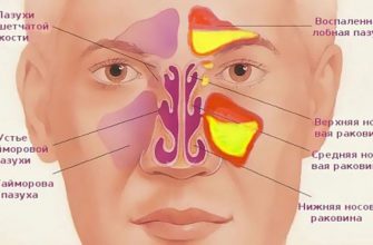 Легко очистите гайморовые и лобные пазухи от гноя и слизи!