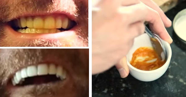 Этот мужчина показал до смешного простой трюк для отбеливания зубов. С секретным ингредиентом! (фото, видео)