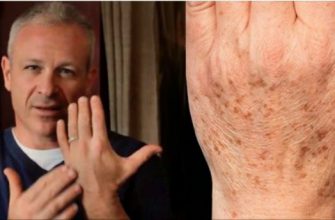 Американский доктор рекомендует: простой способ быстро устранить пигментные пятна на коже. Всего 2 ингредиента!