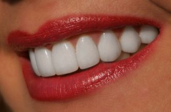 Я очень комплексовала из-за желтых зубов, пока не попробовала этот натуральный отбеливатель