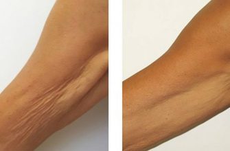 Мощное средство от морщинистой шеи, дряблых рук и рыхлых бедер