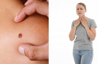 Как вовремя выявить рак? Первые симптомы которые вы можете пропустить.