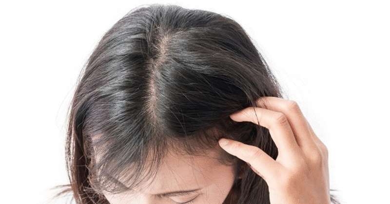 Волосы — индикатор гормонального дисбаланса и дефицита минералов