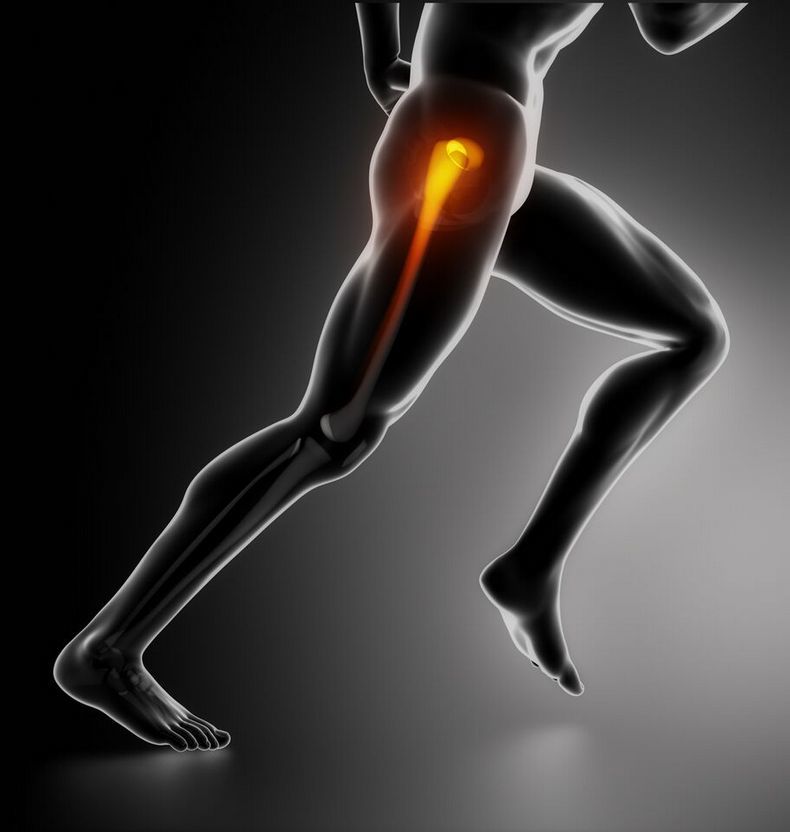 БОЛЬ в бедре 6 советов, которые