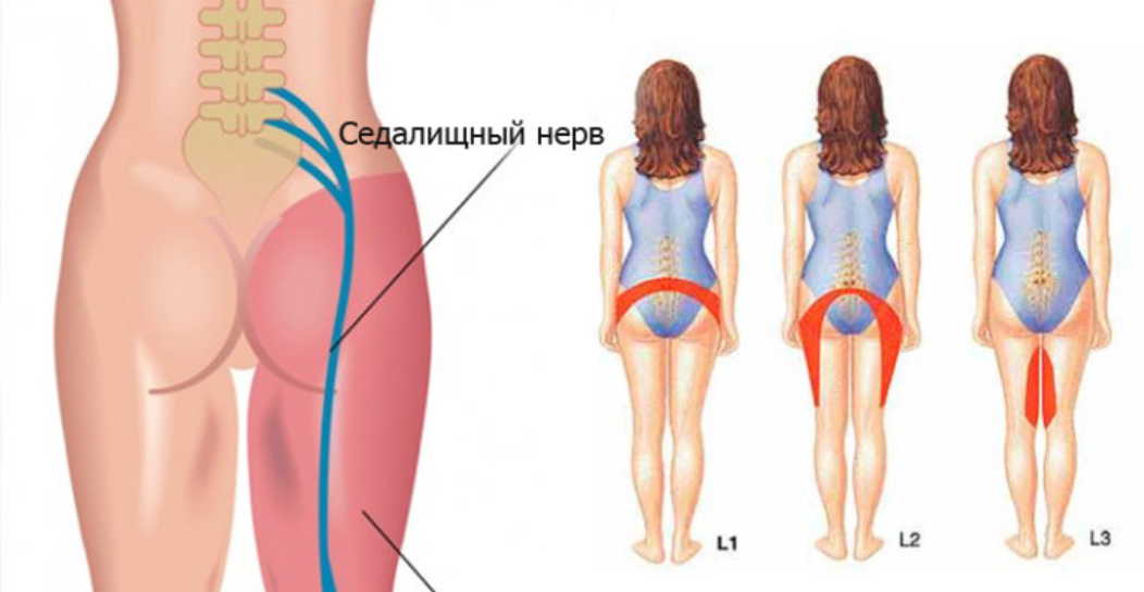 Если ноги стали слабыми — ищите причину в позвоночнике!
