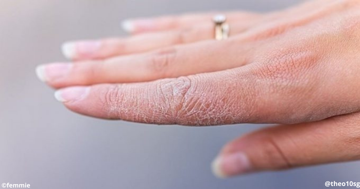 5 зон на теле, которые выдают неухоженную женщину зимой