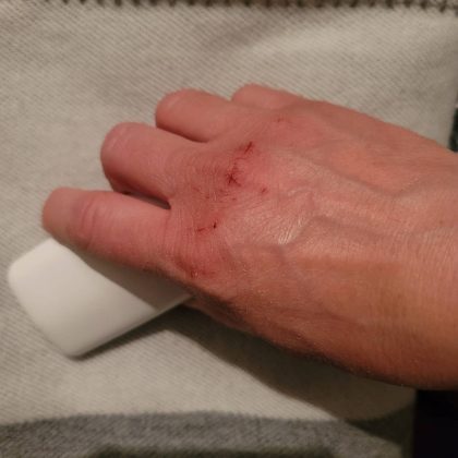 4 зоны на теле, по которым очевидно, женщина запустила себя